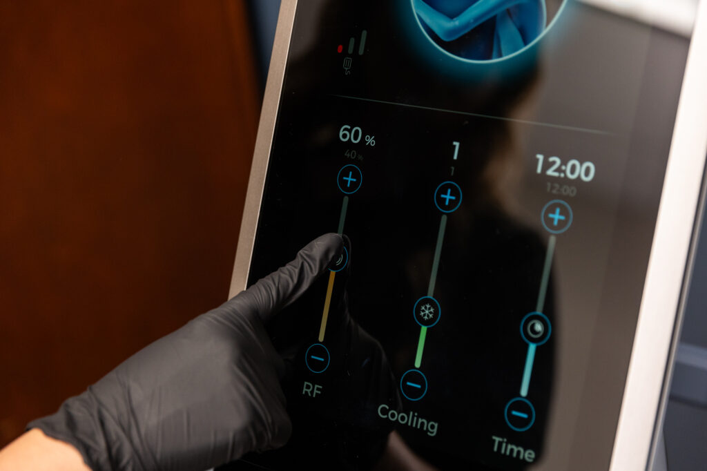A provider's gloved hand adjusts settings on the device for microneedling near Alpharetta, GA, personalizing treatment to the patient.